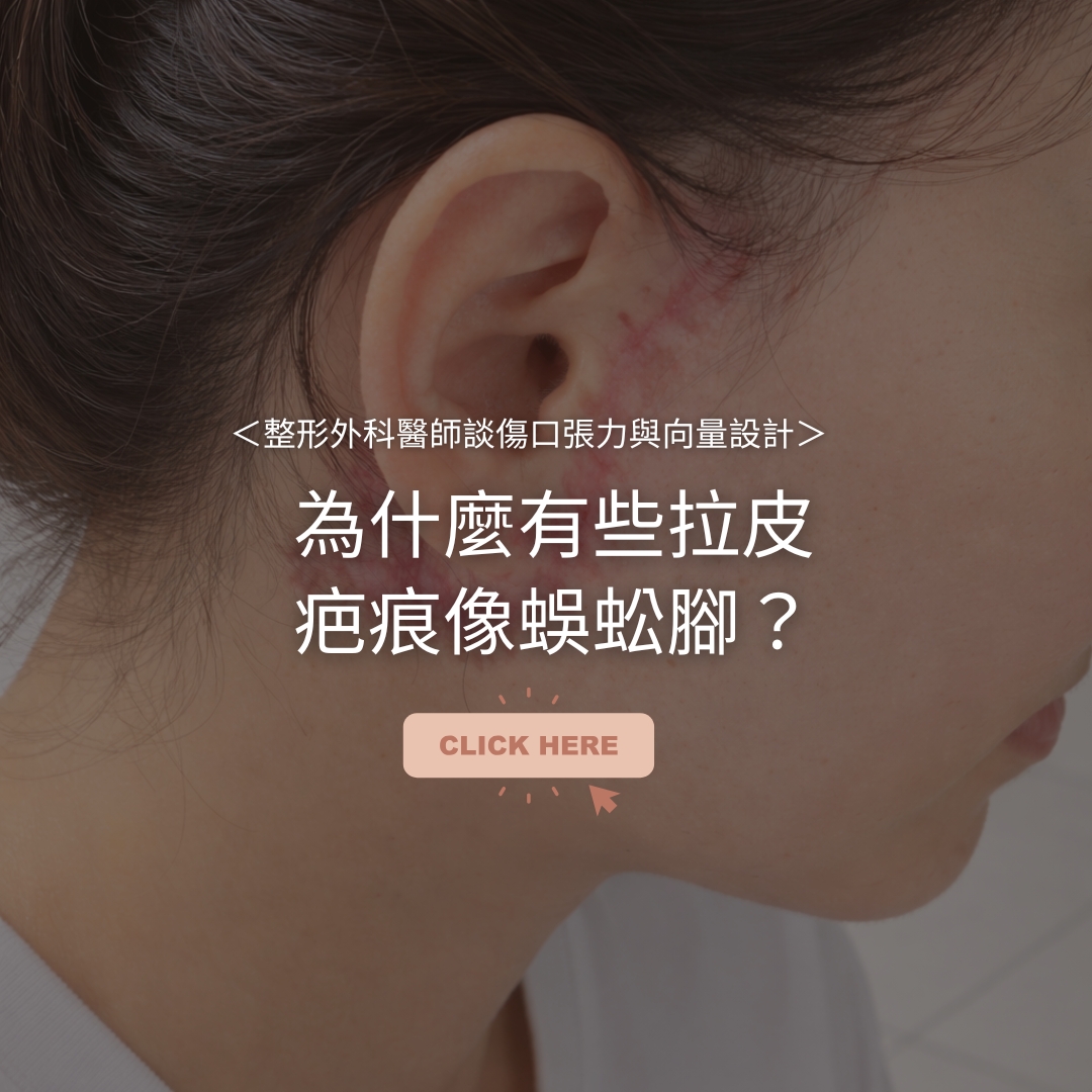 為什麼有些拉皮疤痕像蜈蚣腳？整形外科醫師談傷口張力與向量設計